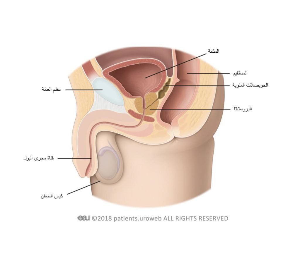 تكلس البروستاتا