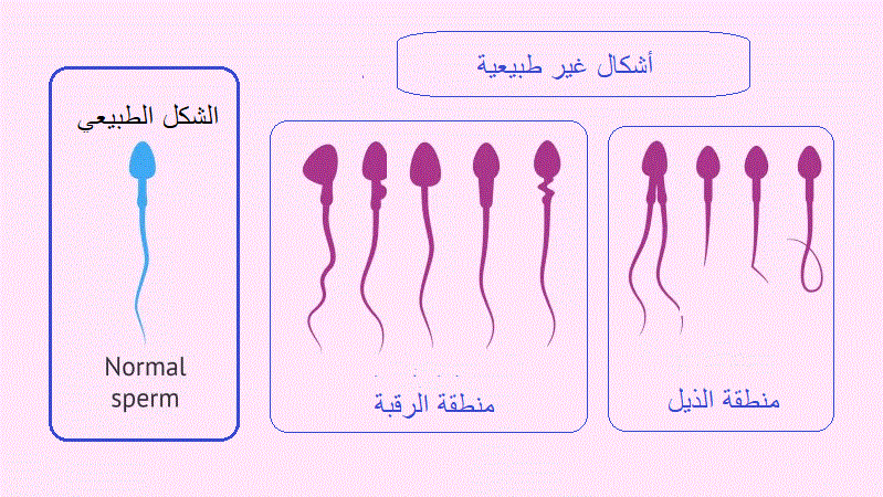 اشكال السائل المنوي