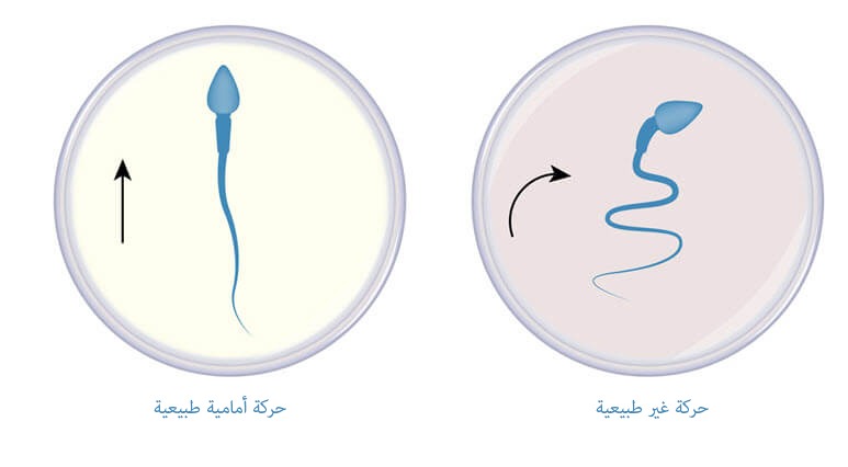 شكل الحيوان المنوى الطبيعى